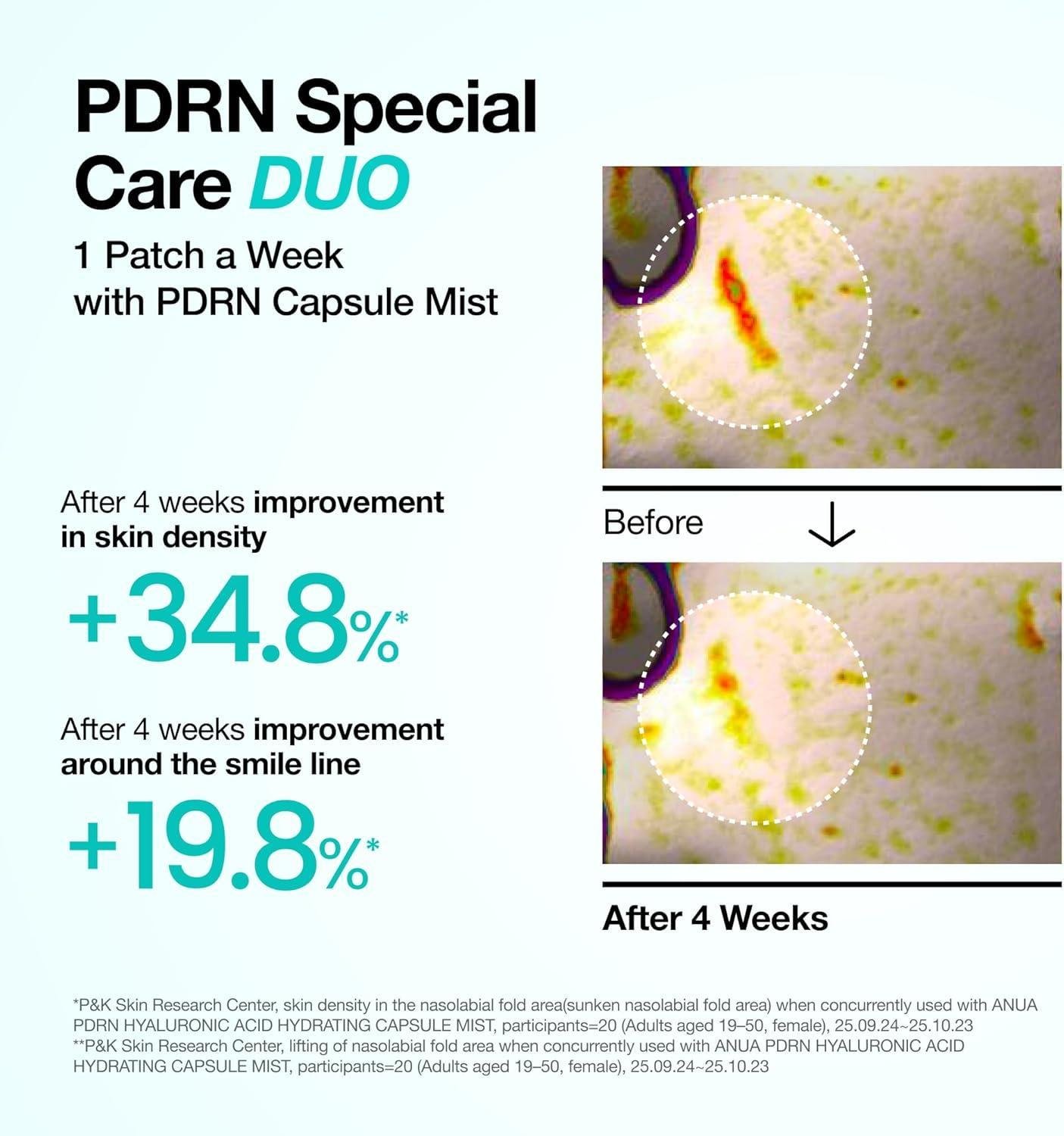 Anua PDRN Collagen Melting Patch For Glass Skin 4 Pairs - Image 6